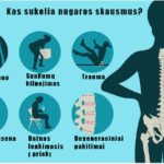 BIOMECHANINĖ NUGAROS SKAUSMO ANALIZĖ : NAUJAUSIAS POŽIŪRIS Į SVEIKĄ STUBURĄ 6 Kas Sukelia Nugaros Skausmus