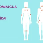 FIBROMIALGIJA: MASAŽAS IR MANKŠTA - NAUDA 5 Fibromialgija