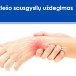Rieso Sausgysles Uzdegimas