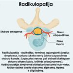 RADIKULOPATIJA-RADIKULITAS 11 Radikulopatija-Radikulitas