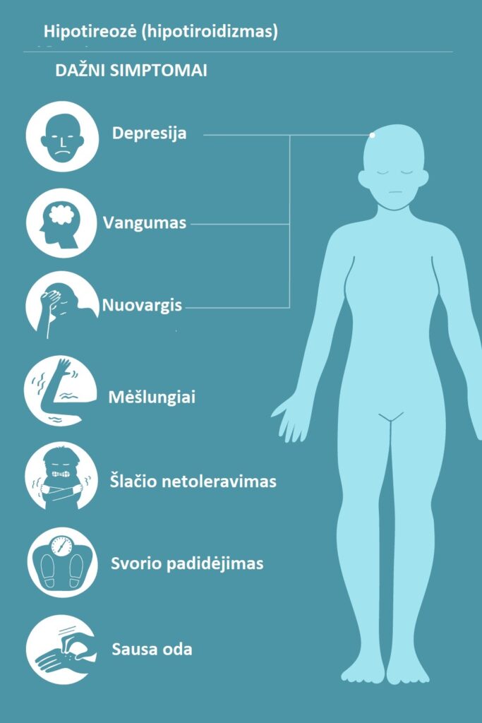Hipotiroze Simptomai