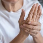 7 RAKTAI Į GYVENIMĄ BE SKAUSMO: ARTRITAS, KINEZITERAPIJA IR MASAŽO GALIA 5 Raumatoidinis Artritas